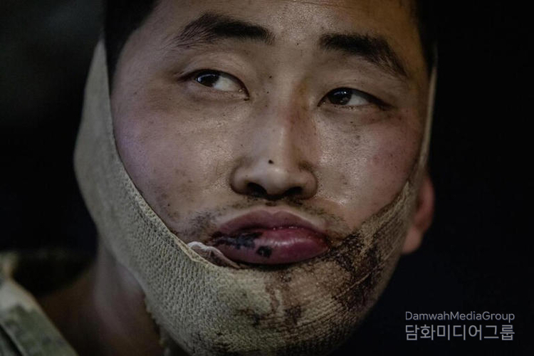 Ukrainian President Volodymyr Zelensky on Jan. 11 (local time) released a photo claiming to have captured two North Korean soldiers who took part in fighting in Russia's Kursk region. A North Korean soldier is pictured in the released photo. / Photo by President Zelensky's Telegram account.<br>
